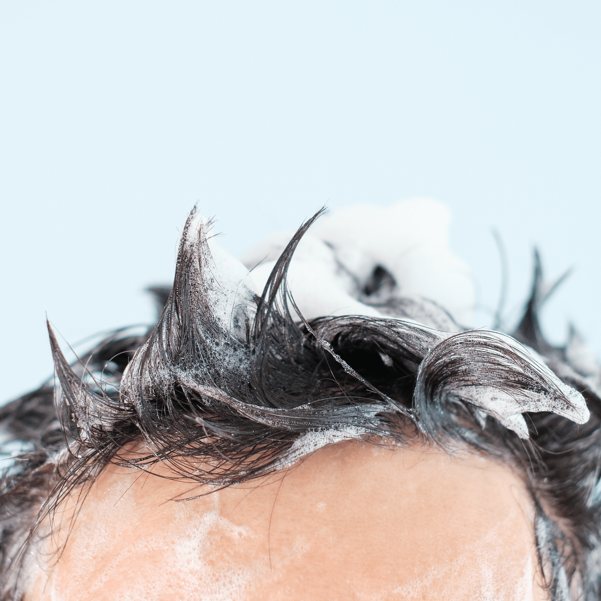 AGA治療 - auravita